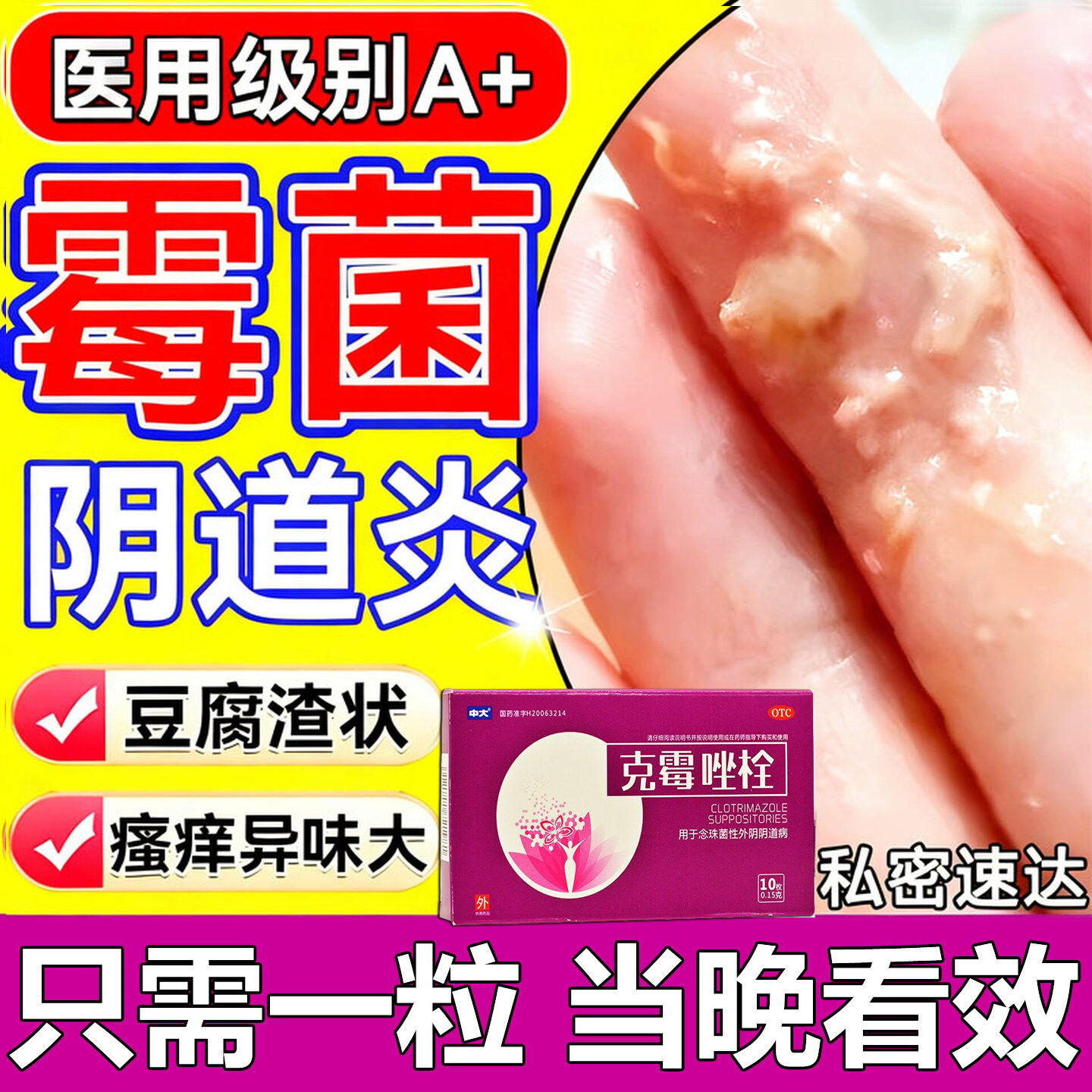 【中大】克霉唑栓0.15g*10粒/盒