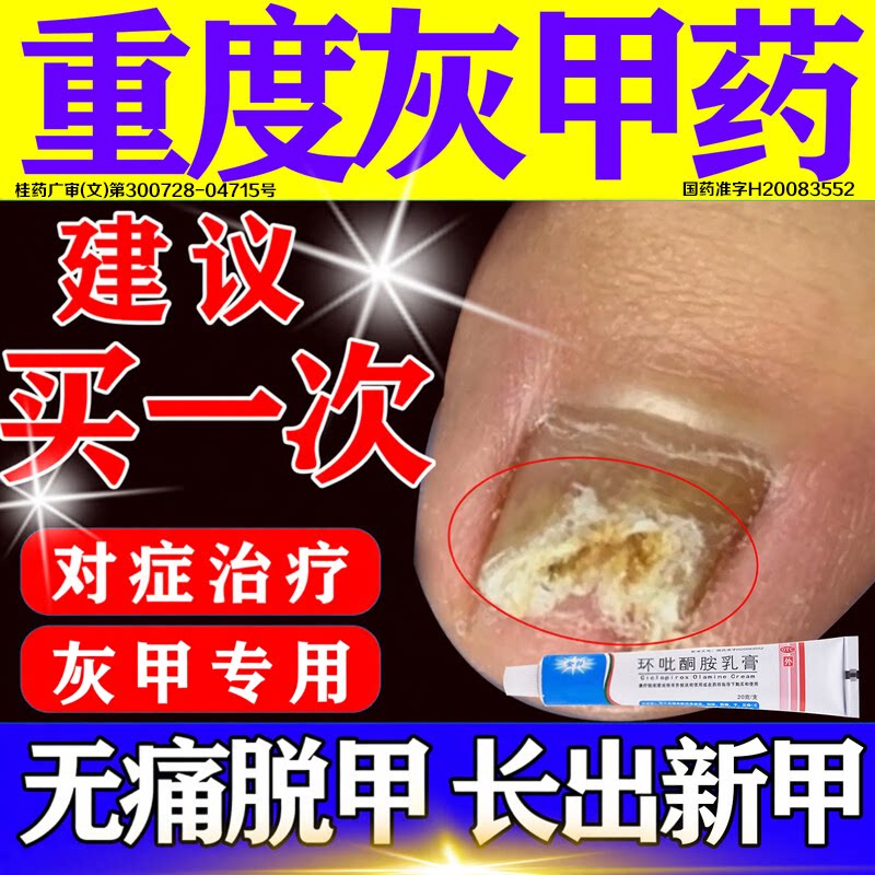 [金归]环吡酮胺乳膏1%*20g*1支/盒