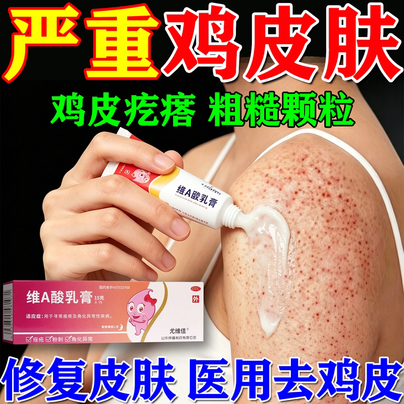 维a酸乳膏医用去鸡皮肤疙瘩毛囊角化药膏去全身除手臂腿专用药膏