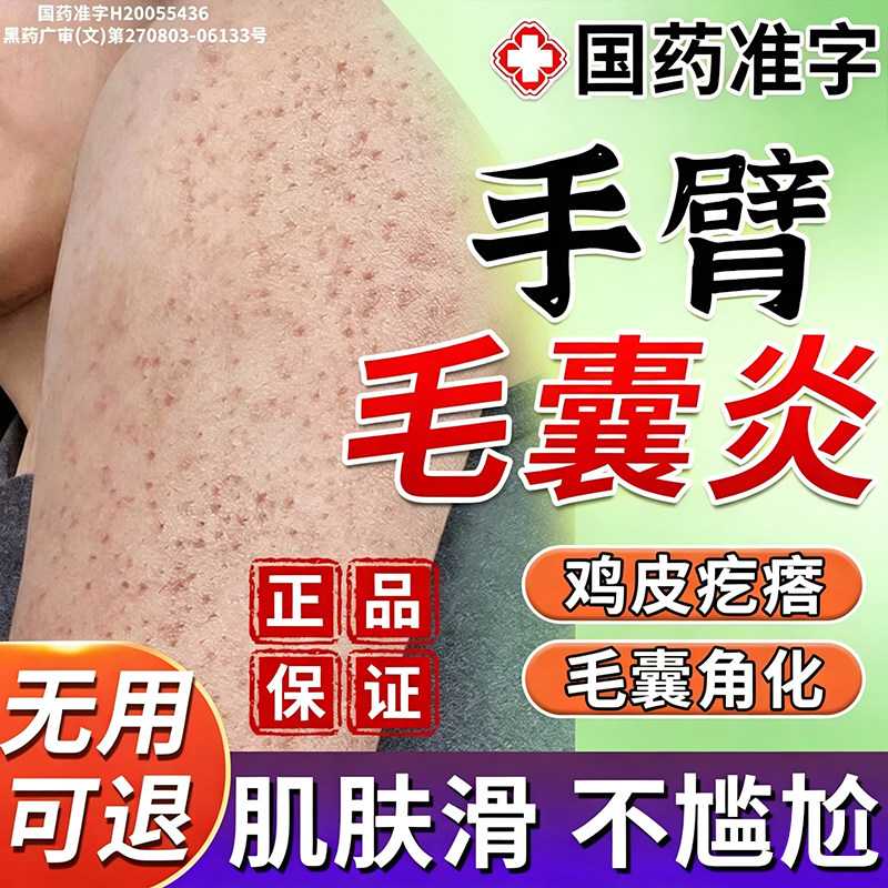 手臂毛囊炎胳膊上长疙瘩治疗马拉色菌毛囊炎专用药膏毛囊特炎效药