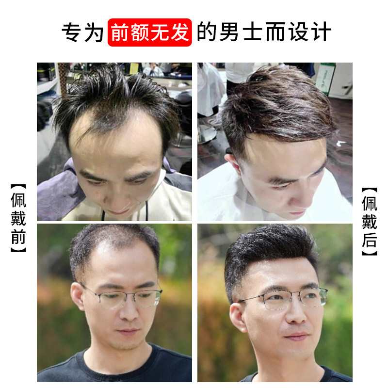 发际线贴假发男前额隐形补发片男士高额头秃顶真发隐形生物膜贴片