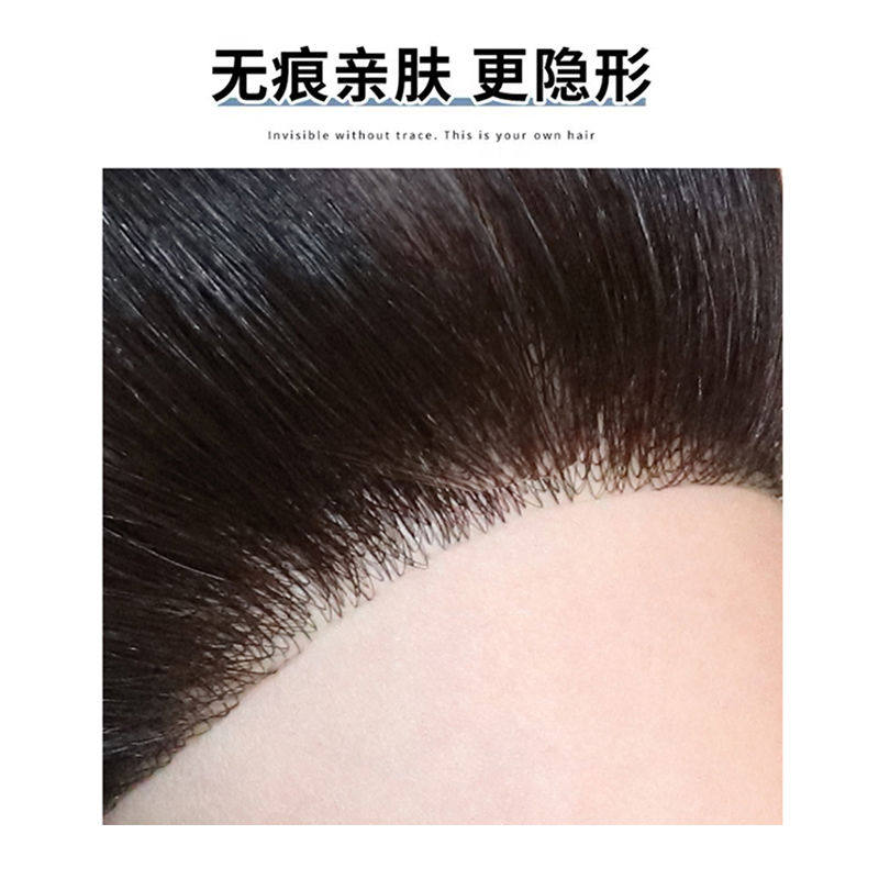 女发际线假发贴片真发前额浏海生物头皮隐形胎毛无痕鬓角补发神器