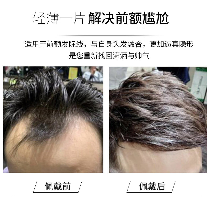 发际线假发贴男士假发片隐形无痕贴片真发M型前额补发片刘海片男图片