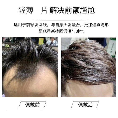 发际线假发贴男士假发片隐形无痕贴片真发M型前额补发片刘海片男