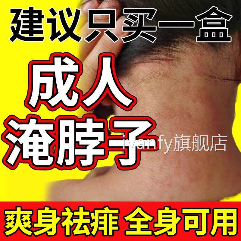 成人痱粉子湿防淹脖子疹非止夏季痒士用吸汗干爽身粉女男士ivanfy