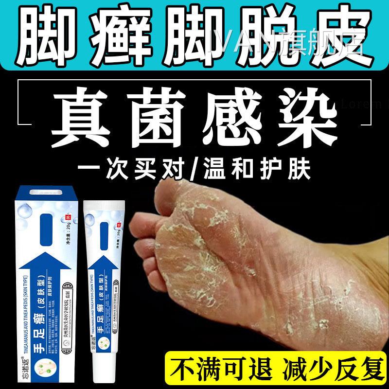 角化型足癣脚癣一次净官脱方旗舰店脚皮干裂真菌感染贵州神奇止UU