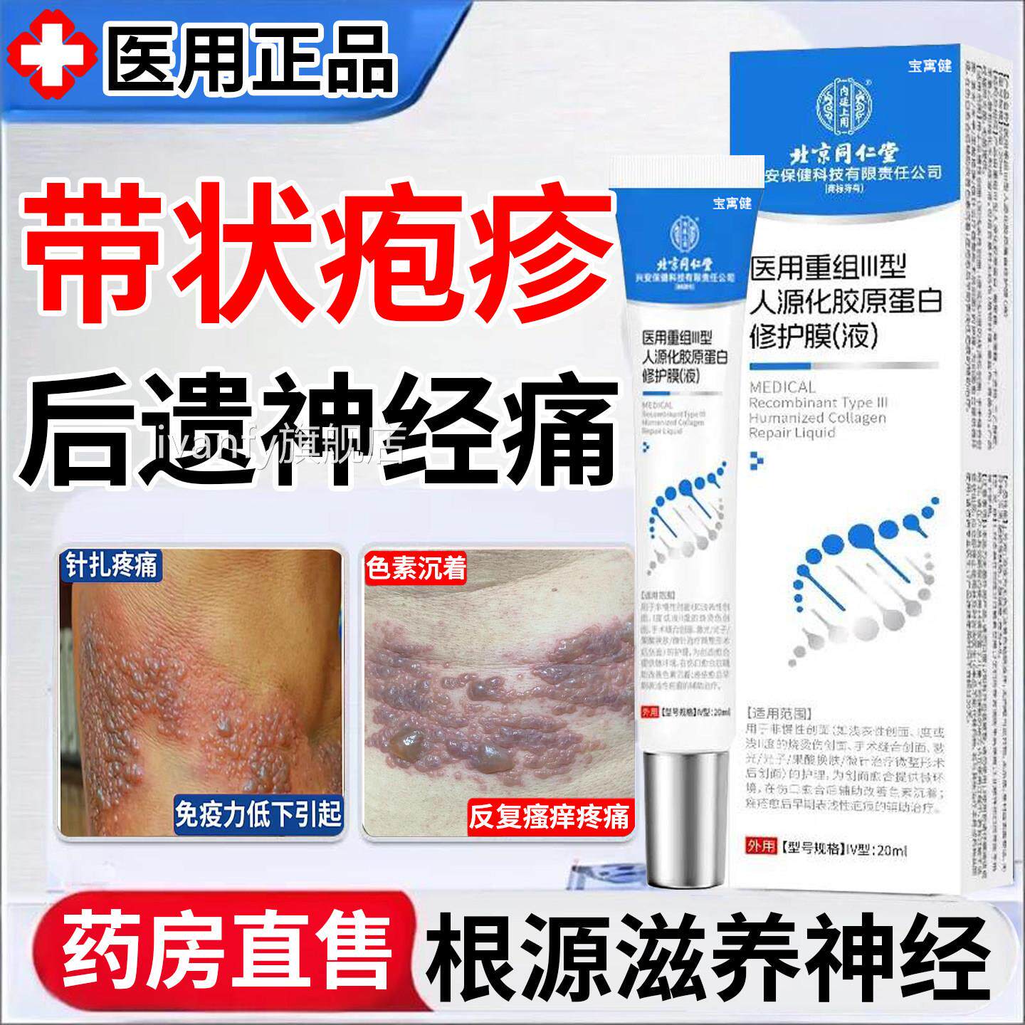 带状疱疹后遗症神经痛外用修复酶蛇盘疮速快止痛特膏药贴效根簖膏