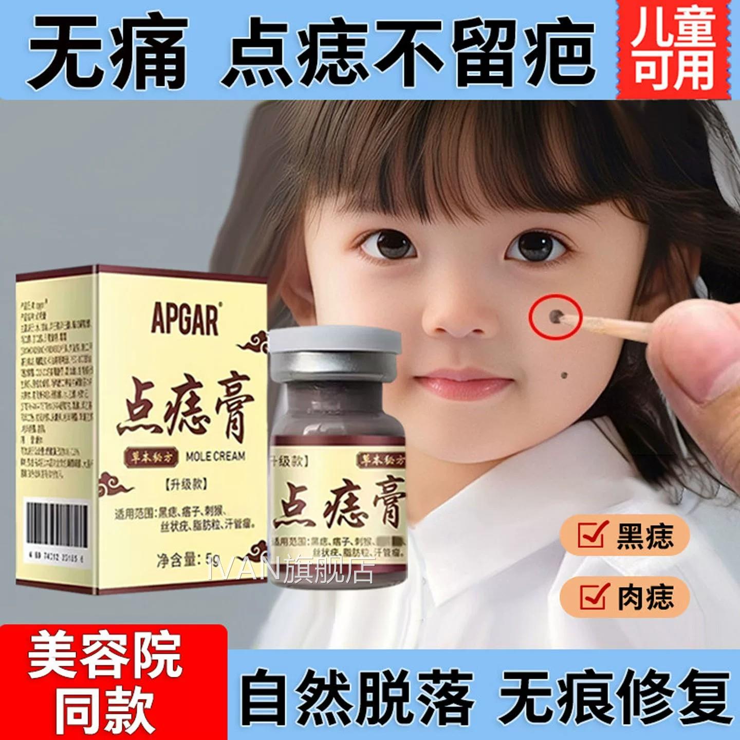 去痣点痣膏无正品非药水脸痕部专用药膏去黑痣美容院不留疤旗舰店
