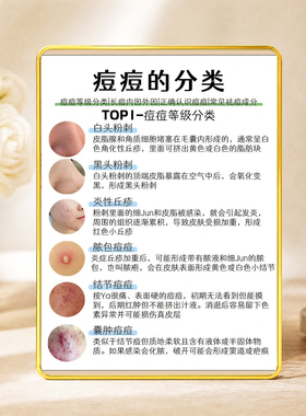 痘痘等级分类皮肤管理店展摆件