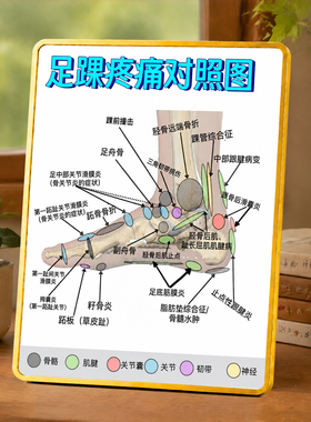 足踝疼痛对照图摆台中医馆理疗馆诊所桌面装饰摆件