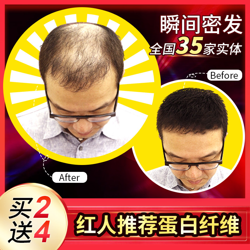 头发纤维粉增发补发视觉密发喷雾量增多发际线填充头顶稀少秃假发