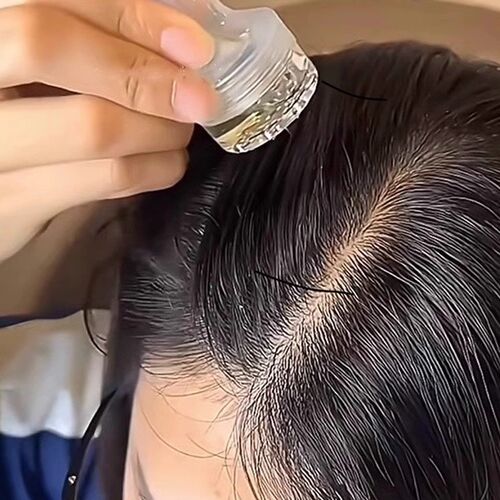 米诺头皮上药器头部按摩滚珠导液梳健发头发精华育发导梳涂抹神器