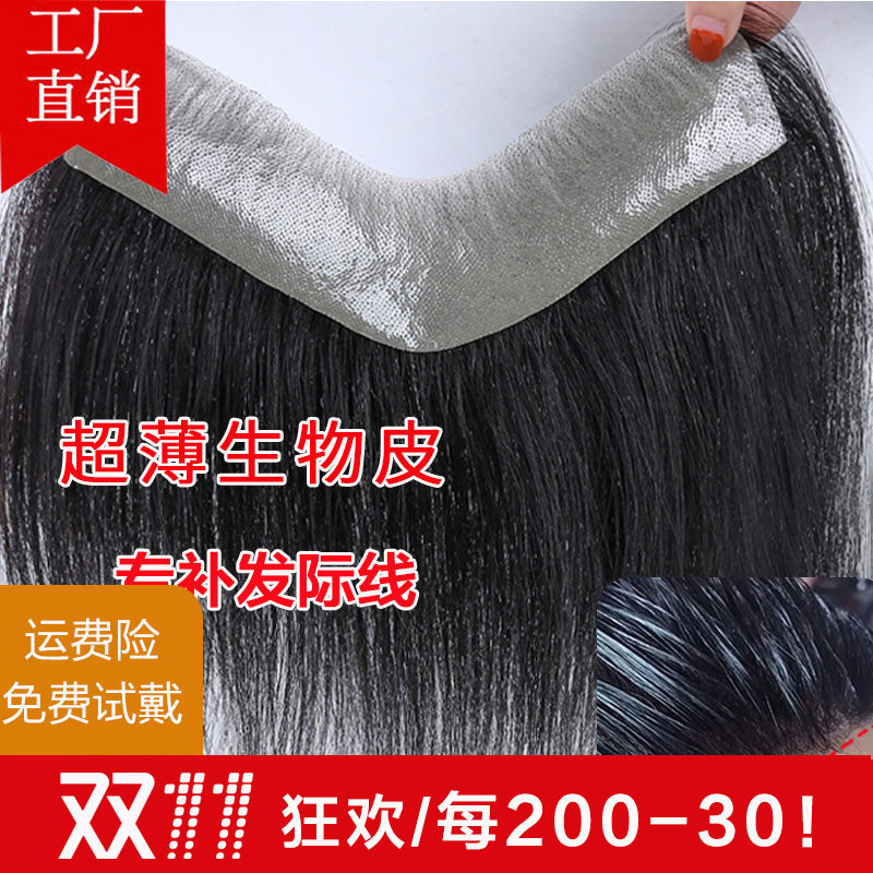 男女发际线假发贴前额补发片刘海全真人发高额头补发无痕隐形发块