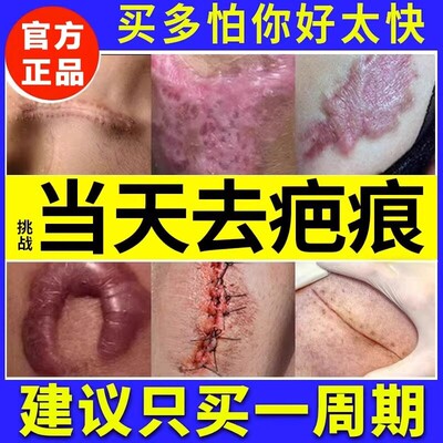 祛疤膏去疤痕增生凸起去除疙瘩修复膏日本除疤儿童疤克烫伤剖腹产