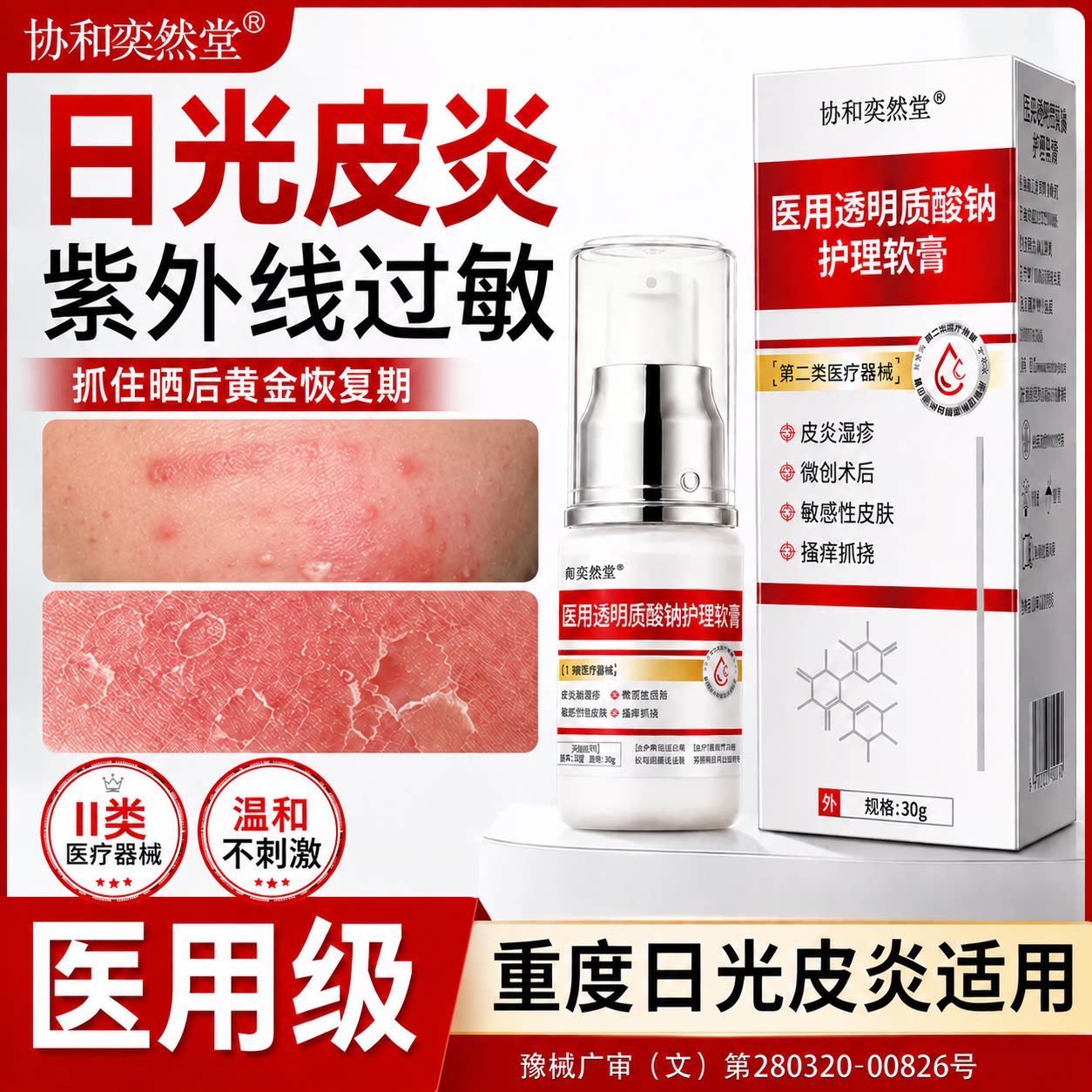 协和奕然堂日光性皮炎湿疹透明质酸钠顽固过敏瘙痒外用止痒抗菌