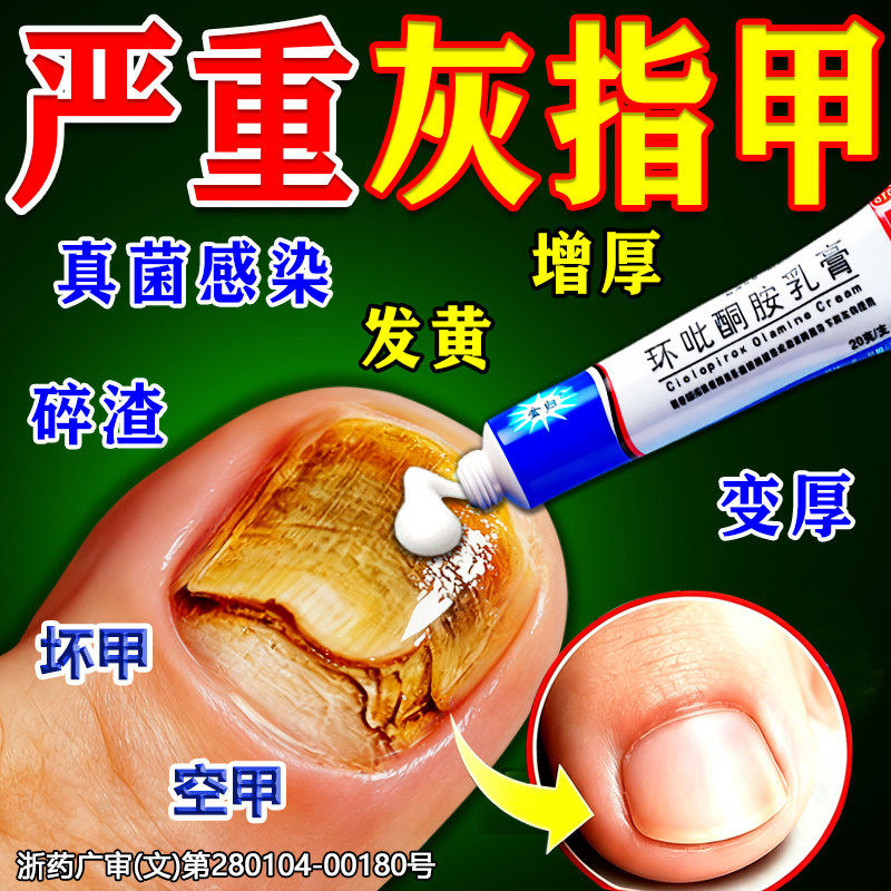 [金归]环吡酮胺乳膏1%*20g*1支/盒