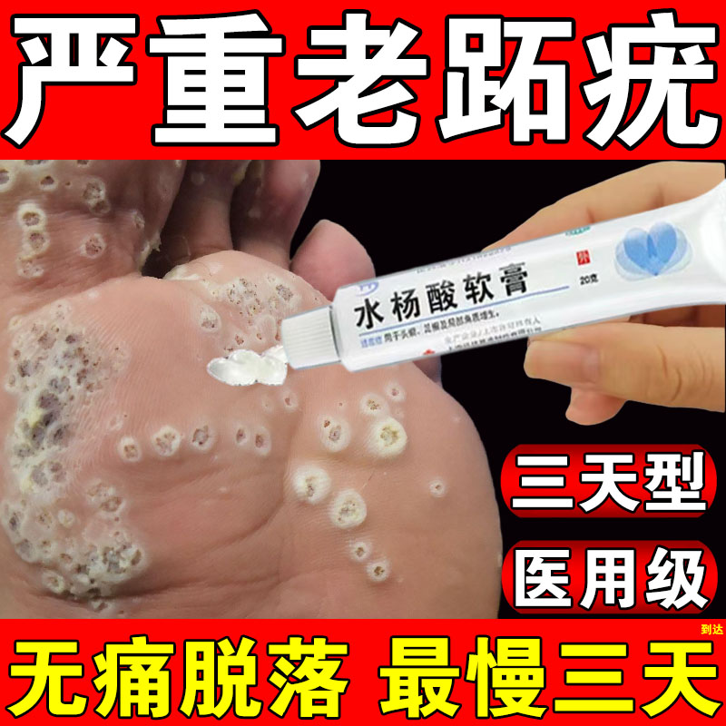 医用水杨酸软膏正品去疣扁官方旗舰店跖疣软化角质高浓度百分之15