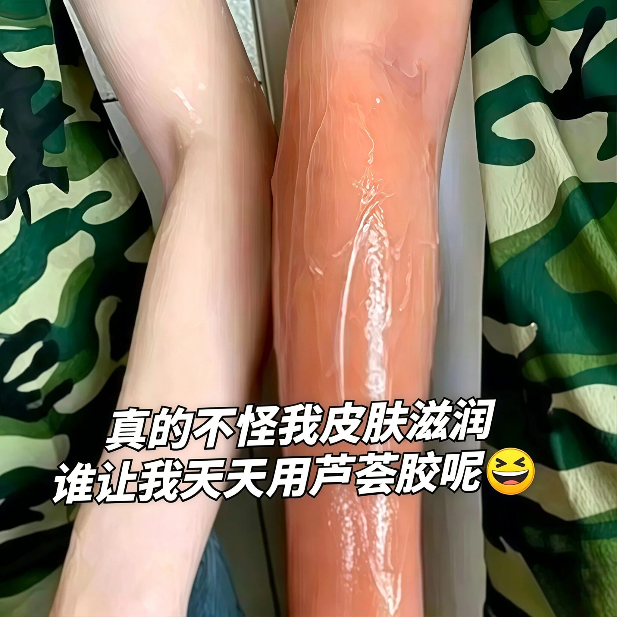 军训晒后修复芦荟胶补水镇静