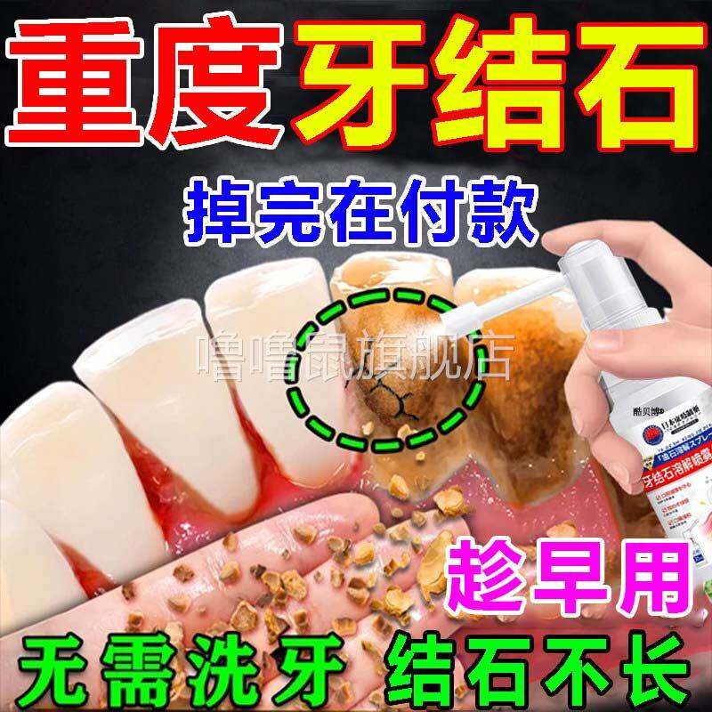 噜噜鼠正品牙结石去除器溶解牙石效速清理工具黄牙黑烟渍牙垢牙菌