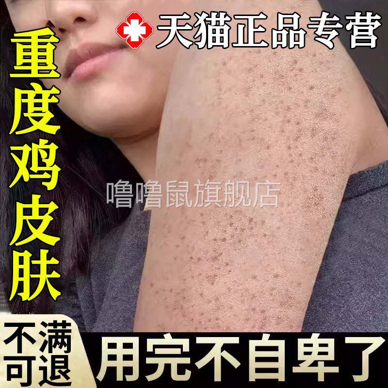 噜噜鼠正品鸡皮肤疙瘩毛囊角化症专用膏药贴膏HM手臂毛囊炎胳膊上
