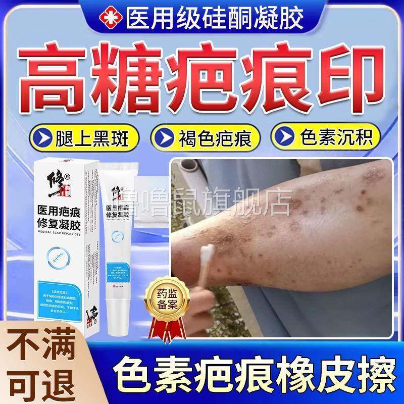 噜噜鼠正品糖尿病疤痕印小腿黑斑胫前糖斑发黑旧伤脚疤皮肤黑斑点