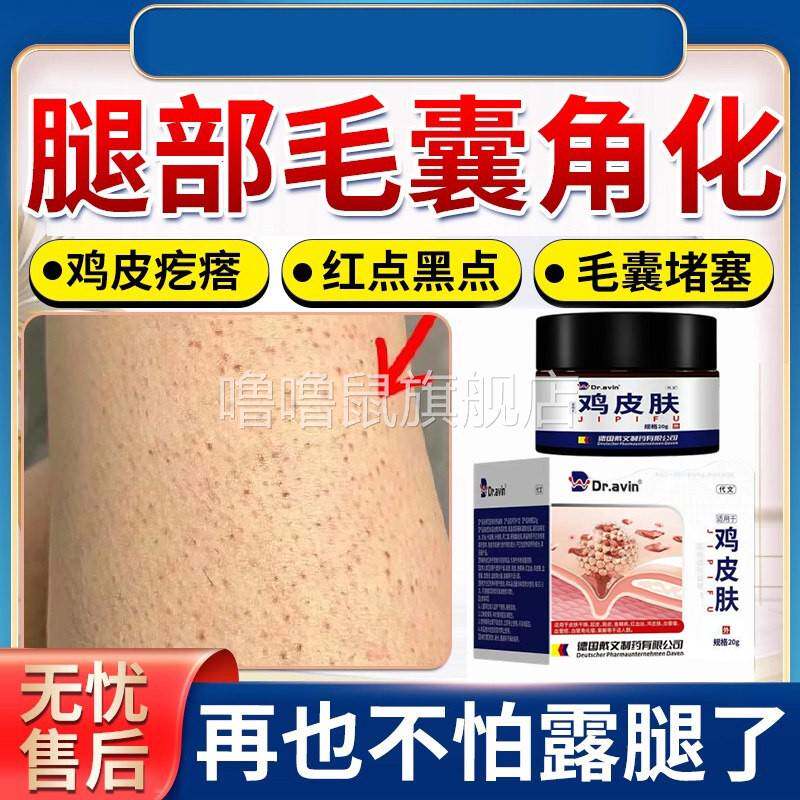 噜噜鼠正品腿上毛孔堵塞去鸡皮肤疙瘩毛囊炎周角化症药监备案膏搭