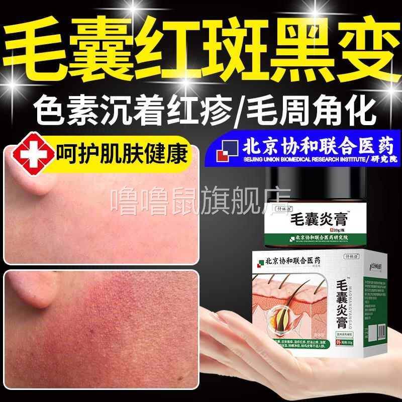噜噜鼠正品面部毛囊红斑黑变毛周角化症儿童脸颊两边小疙瘩去鸡皮