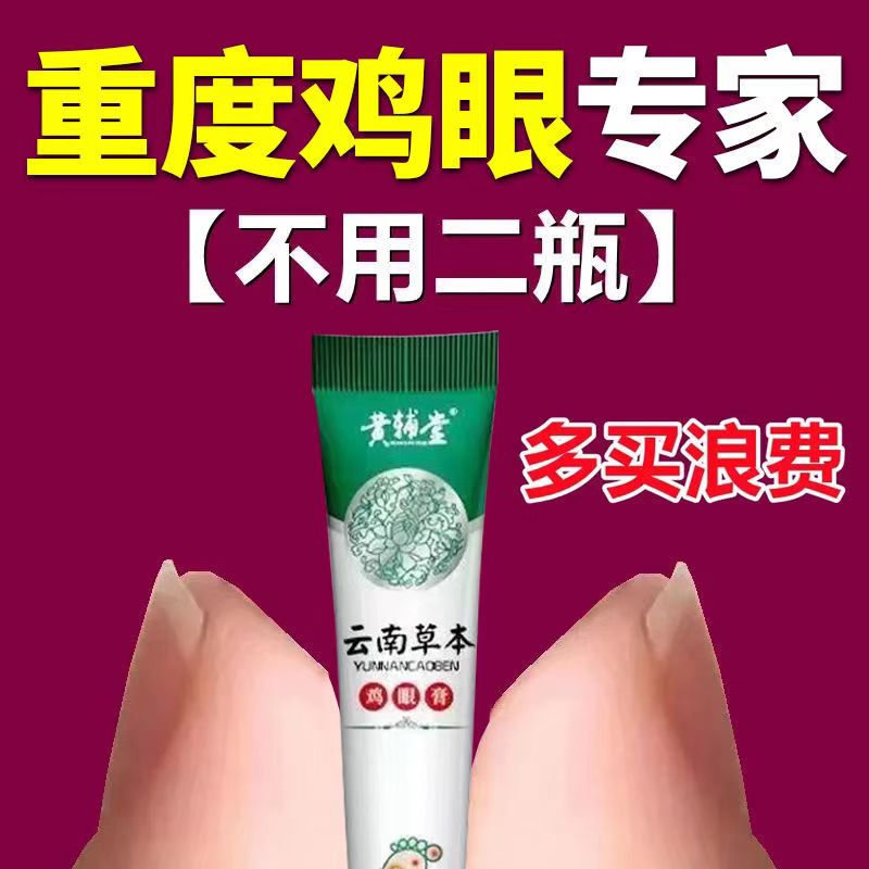 老茧老死皮手茧鸡眼膏去老茧肉刺