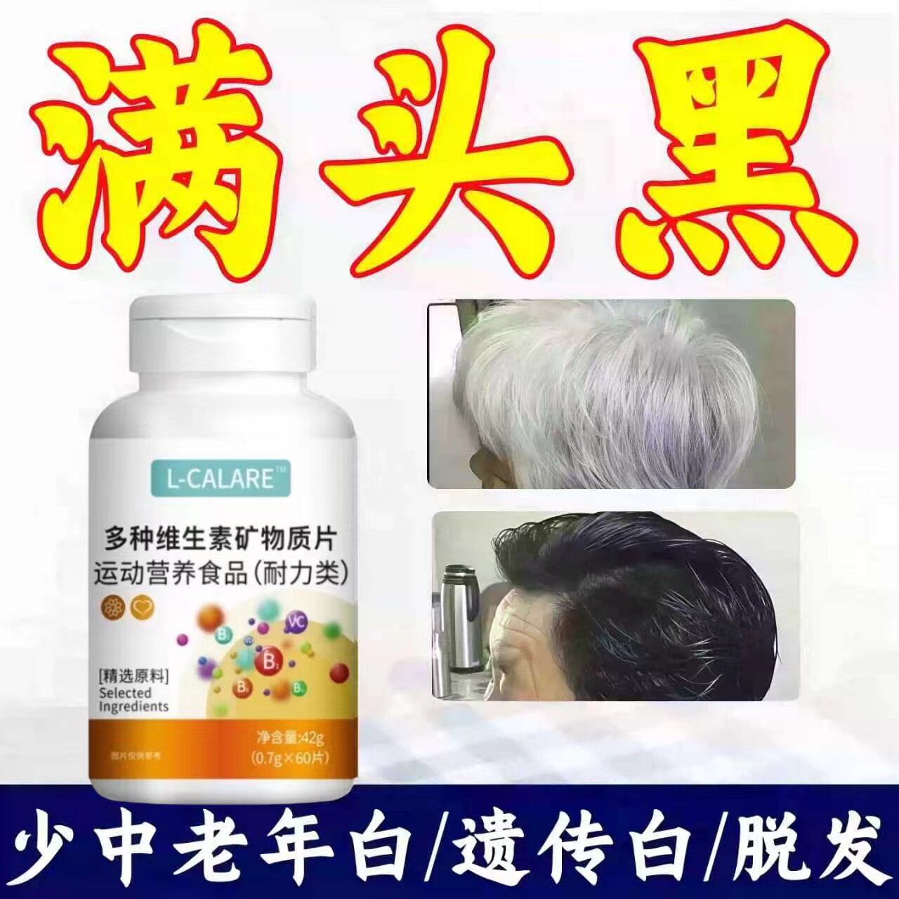 星维生素b乌发素高元复合维生素养出好发质轻松显年轻Bei5