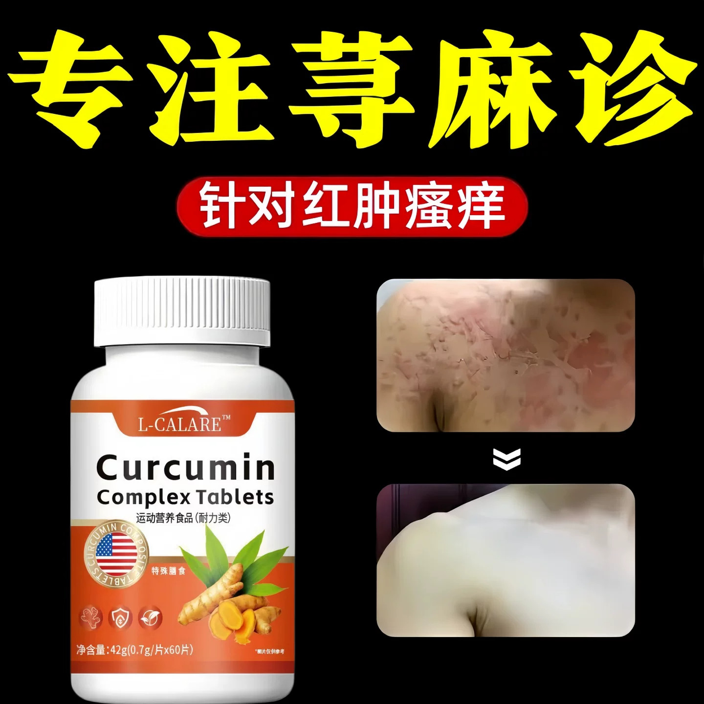 達爾維舒敏宝荨麻风团疹子
