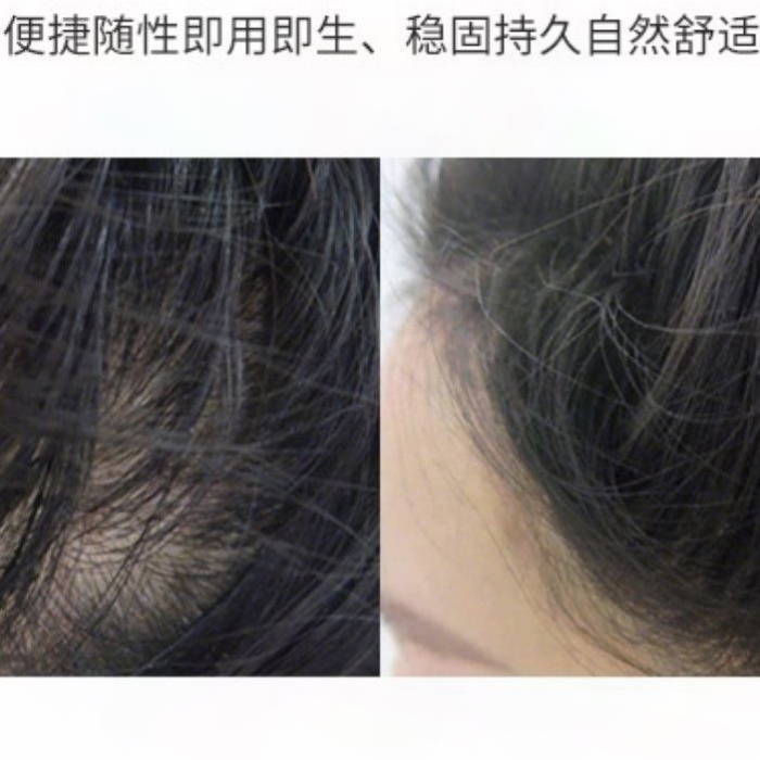 喷粉瓶头发増发密发纤维粉喷瓶男女发际线补发増发神器发际线神器