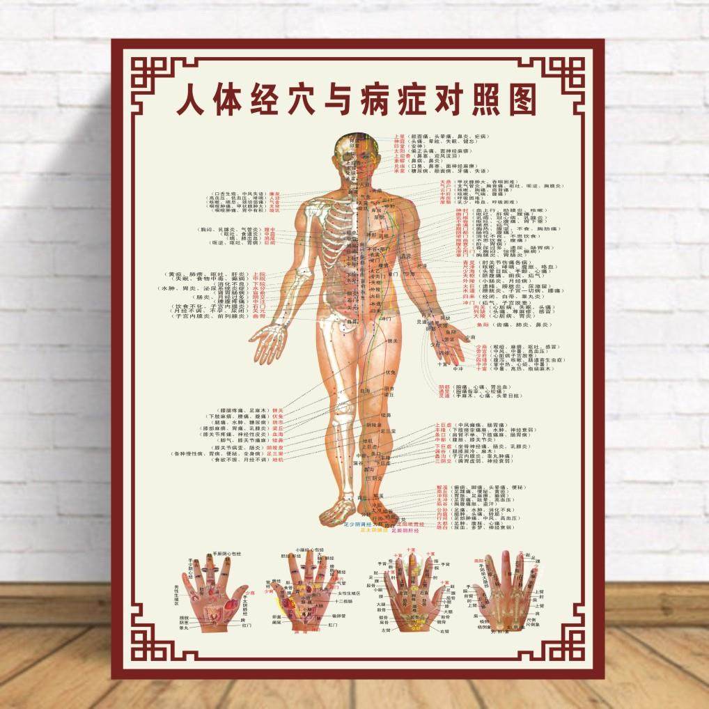 中医养生人体经穴与病症对照图经络穴位针炙对照高清海报超大挂图