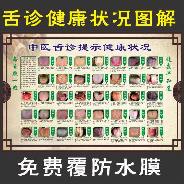 医院挂图 舌诊健康状况对照表图解中医理疗 口腔疾病保健海报贴画