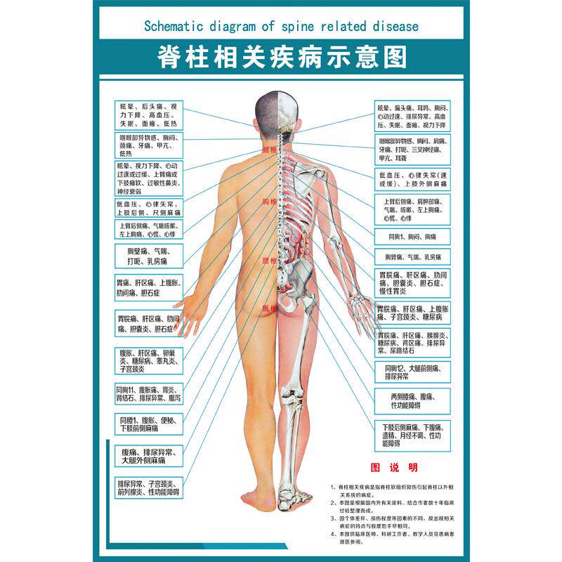 医学骨科挂图 脊柱相关疾病示意图 PVC高清写真防水耐用不掉色