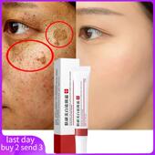 Dark Whitening Spo Remove Melasma Freckle Cream