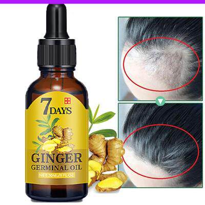 Hair Loss Treatment Ginger Growth Essence Oil老姜头发养护油