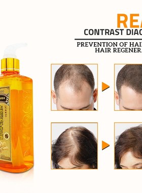 Ginger Hair Shampoo&Conditioner生姜洗发液洗发水洗发露300