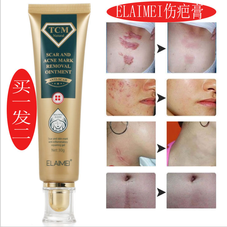 疤痕修护膏疤痕除印痕修护膏手术疤凹凹妊娠纹修护痘坑烫伤正品