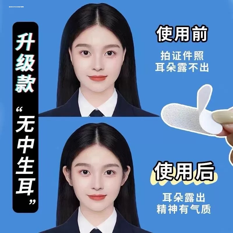 贴面耳神器精灵耳贴招风耳立耳贴定型变硅胶显脸小耳朵贴脸女神