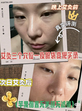 所有女生一起做艾灸！颜面如镜，五脏六腑之华