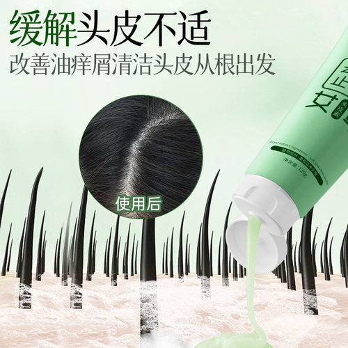 【官方严选】艾草去屑止痒头皮素清洁头皮控油蓬松温和护理深层