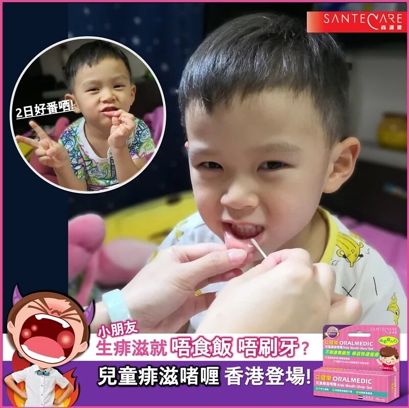 香港舜妈 口腔儿童痱滋啫喱/膏 无刺激