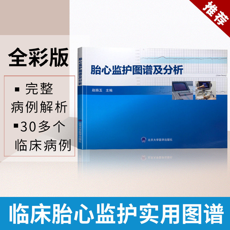 赵扬玉  产前胎心监护图形 产时胎心监护图形 北京大学医学出版社