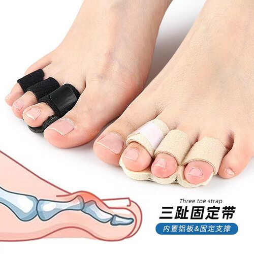 固定带锤状趾可调分趾器