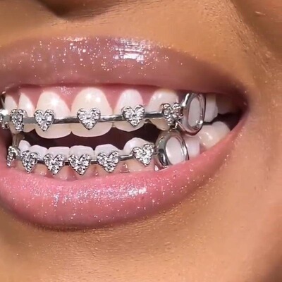 Connection Side Hollowedout Grillz Copper Inset Synthetic