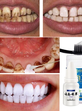 Teeth Whitening Oral Teeth Care Tooth Cleaning WhiteningTool