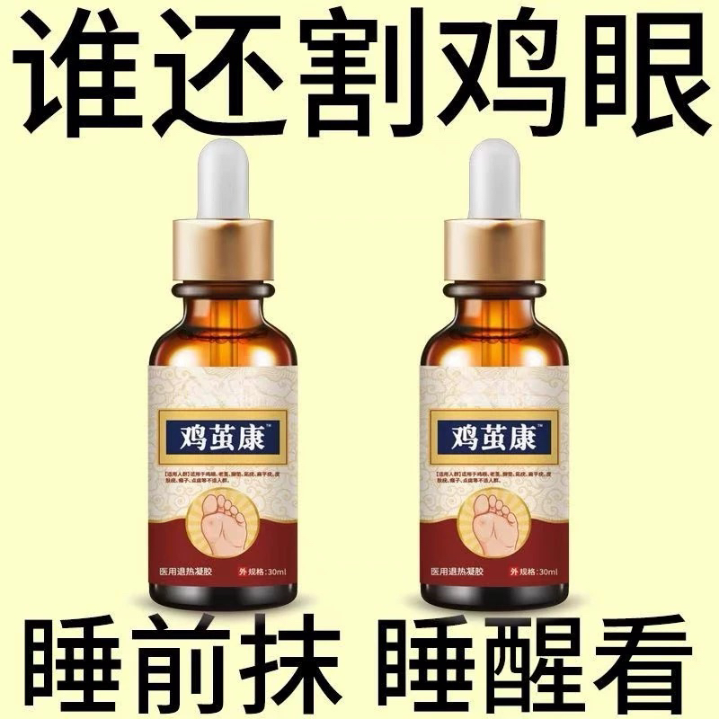鸡茧康脚茧老茧手足厚茧硬皮鸡眼身体脚趾关节茧脚垫正品鸡眼膏