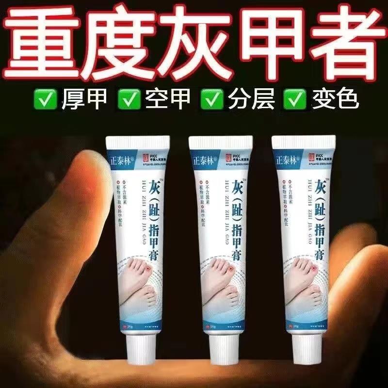 灰趾指甲膏正品抑菌液增厚修复灰甲液草本无痛亮甲祛灰指甲甲沟炎