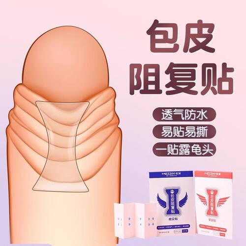 包皮阻复贴过长矫正器
