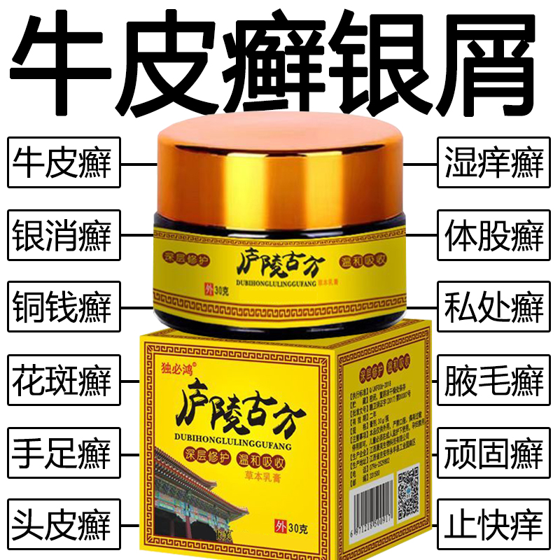 股藓过敏湿疹止痒根去皮肤专用特效正品杀菌药膏治